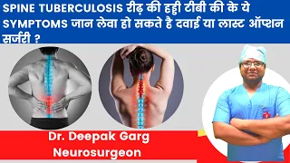 Spine Tb Treatment In Hindi | रीढ़ की हड्डी टीबी का इलाज | Spine tuberculosis Symptoms & Diagnosis