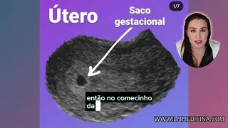 SACO GESTACIONAL VAZIO