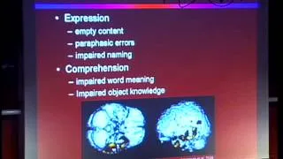 Frontotemporal Dementia - FTD (Murray Grossman)