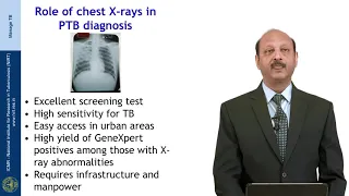 Approach to diagnosis of Pulmonary TB