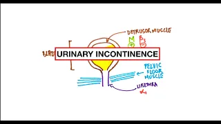 Urinary Incontinence - Stress, Urge, Overflow: Pathophysiology, Clinical correlation | USMLE | MCQs