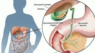 "Хорошая" новость для поберухи.