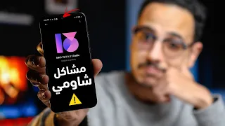 دي أغرب مشاكل قابلتني في موبايلات شاومي الأخيرة !!! 🤔