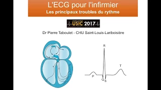 6c. Les principaux troubles du rythme ECG à l'usage de l'infirmier. Dr Taboulet