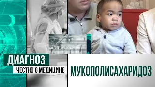 Мукополисахаридоз: симптомдары және диагностикадағы мәселелер | Диагноз