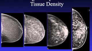 Introduction to Mammography