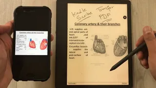 How to Transfer PDF File From Android Phone to Amazon Kindle Scribe