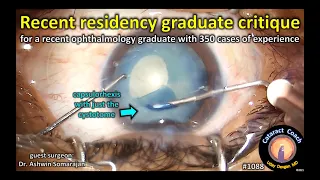 CataractCoach 1088: recent residency graduate cataract surgery