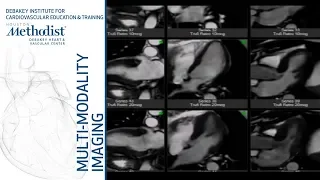 Stress MRI: Methodology, Current Role, and Case Studies (Eric Y. Yang, MD, PhD) October 23, 2018