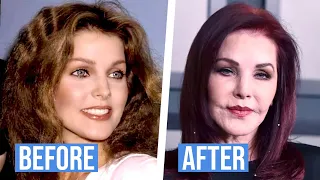 TOP 10 CELEBRITIES PLASTIC SURGERY DISASTERS