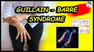 What is Gillian Barre Syndrome | Symptoms | Causes | Treatment | Complications | English | 2022