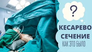 Кесарево сечение | Идти или не идти на кесарево