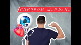 СИНДРОМ МАРФАНА |  Генетические заболевания