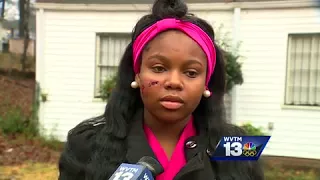 Teenage girl survives gunshot to face