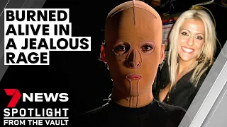 The girl behind the mask: set alight in a jealous rage and scarred for life | 7NEWS Spotlight