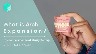 Using invisible aligners for arch expansion | Inside the science of teeth straightening