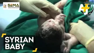 Doctors Save Syrian Baby After Shrapnel Hits Mother