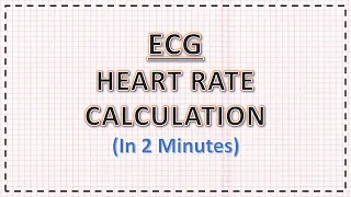 ECG: Heart Rate Calculation | In 2 minutes | ECG Interpretation