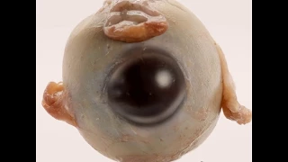 Muscles of the Eyeball