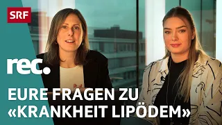 Q&A zur Reportage «Chronische Krankheit Lipödem» | Reportage | rec. | SRF