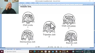 Head and neck surgery in Arabic 2 ( Cleft palate  ) , by Dr. Wahdan .