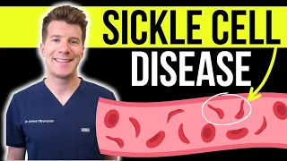 Doctor explains SICKLE CELL DISEASE | Causes, symptoms and treatment