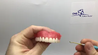 Wax Carving for Complete Dentures