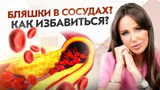 Бляшки в сосудах? Лучшие продукты для сердечно-сосудистой системы