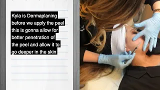 Dermaplaning Treatment in Seattle