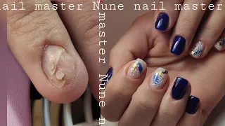 Nune nail master _ կորցրած եղունգի վերանորոգում 😱