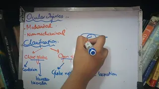 OCULAR INJURIES CLASSIFICATION made easy