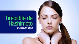 Tireoidite De Hashimoto Tratamento Natural