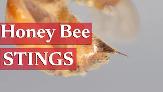 An Overview of Honey Bee Stings | Beekeeping Academy | Ep. 7