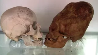 COMING  THE LARGEST DNA EVIDENCE OF ELONGATED SKULLS FROM PERU