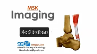 Imaging of Ankle joint and foot (II) (DRE) Prof. Mamdouh Mahfouz