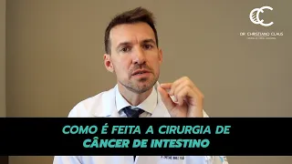 COMO É FEITA A CIRURGIA DE CÂNCER DE INTESTINO?