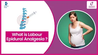 How an epidural is given during childbirth -Dr.Lavanya Gadi at Cloudnine Hospitals | Doctors' Circle