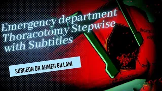 Emergency Department Thoracotomy Stepwise With Subtitles and Easiest Steps