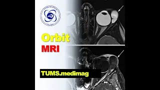Medimag: Planning and positioning in Orbit MRI