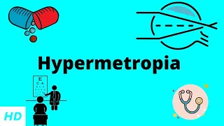 HYPERMETROPIA, Causes, Signs and Symptoms, Diagnosis and Treatment.