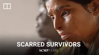 India’s women rise up after acid attacks