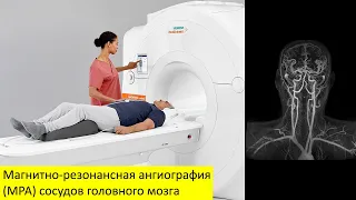 Магнитно резонансная ангиография (МРА) сосудов головного мозга