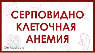 Серповидноклеточная анемия: что такое, механизм развития, симптомы, принцип лечения