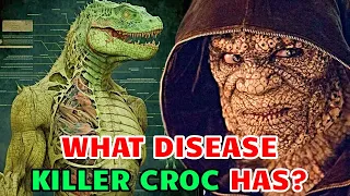 Killer Croc Anatomy - Can Killer Croc Have A Baby? How He Became Like This? & Other Q's Answered