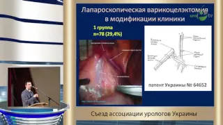 Шамраев С Н - Лапароскопическая варикоцелэктомия при различных типах варикоцеле у мужчин репродукт