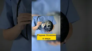 Редкие болезни в мире👨‍⚕️🩺🌍 #рекомендации