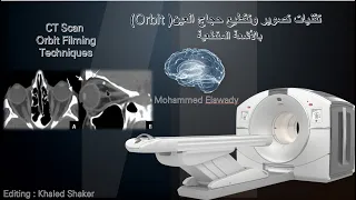 تقنيات تصوير وتقطيع حجاج العين بالاشعة المقطعية | CT Scan Orbit ImagingTechniques