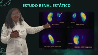 CINTILOGRAFIA RENAL - DIAGNÓSTICO POR IMAGEM