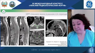 Симпозиум GE "Современная детская нейроонкология"