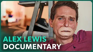 L'affaire Extraordinaire d'Alex Lewis (Documentaire de Miracle Médical) - Real Stories